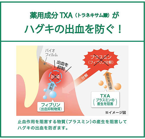 歯ぐきからの出血を防ぐ「ガム・デンタルペーストAC」