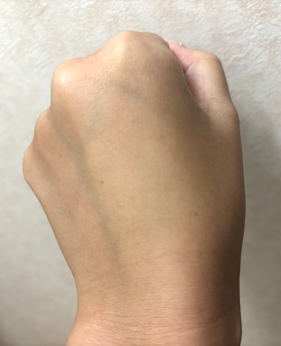 フォト