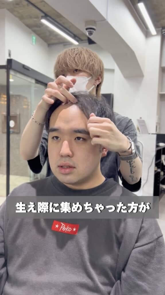 生え際が気にならない髪型を提案