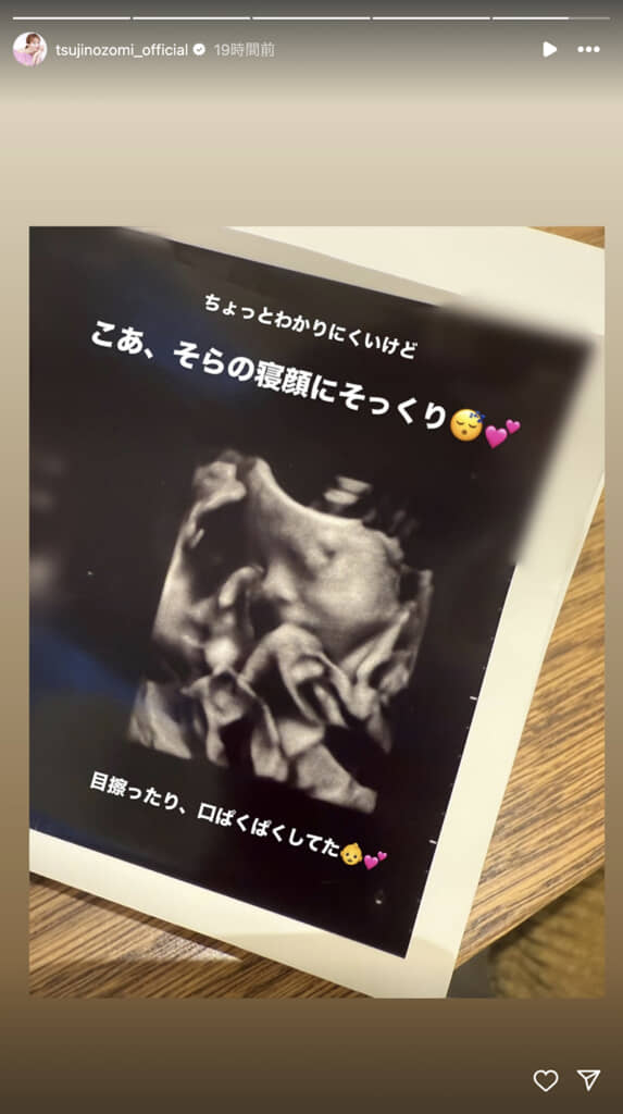 赤ちゃんの顔がはっきり写っています