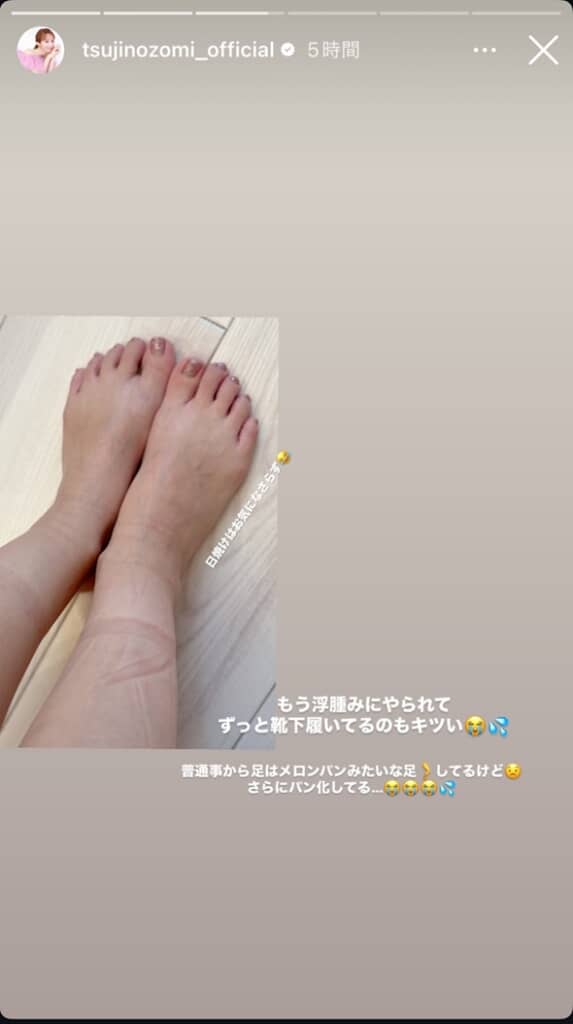 浮腫みについての悩みを吐露