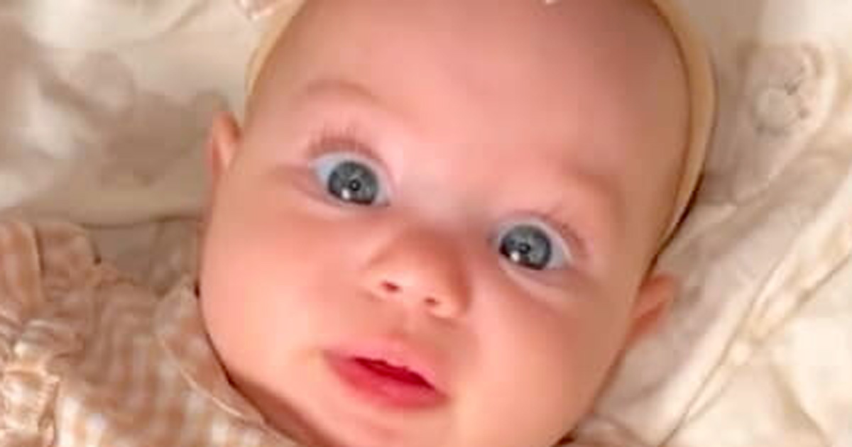 「目が青いのは赤ちゃんだから」と思っていたママ、10カ月後……　驚きの姿に「美しい目」「アンティーク人形のよう」【海外】（1/3） | ライフスタイル ねとらぼ