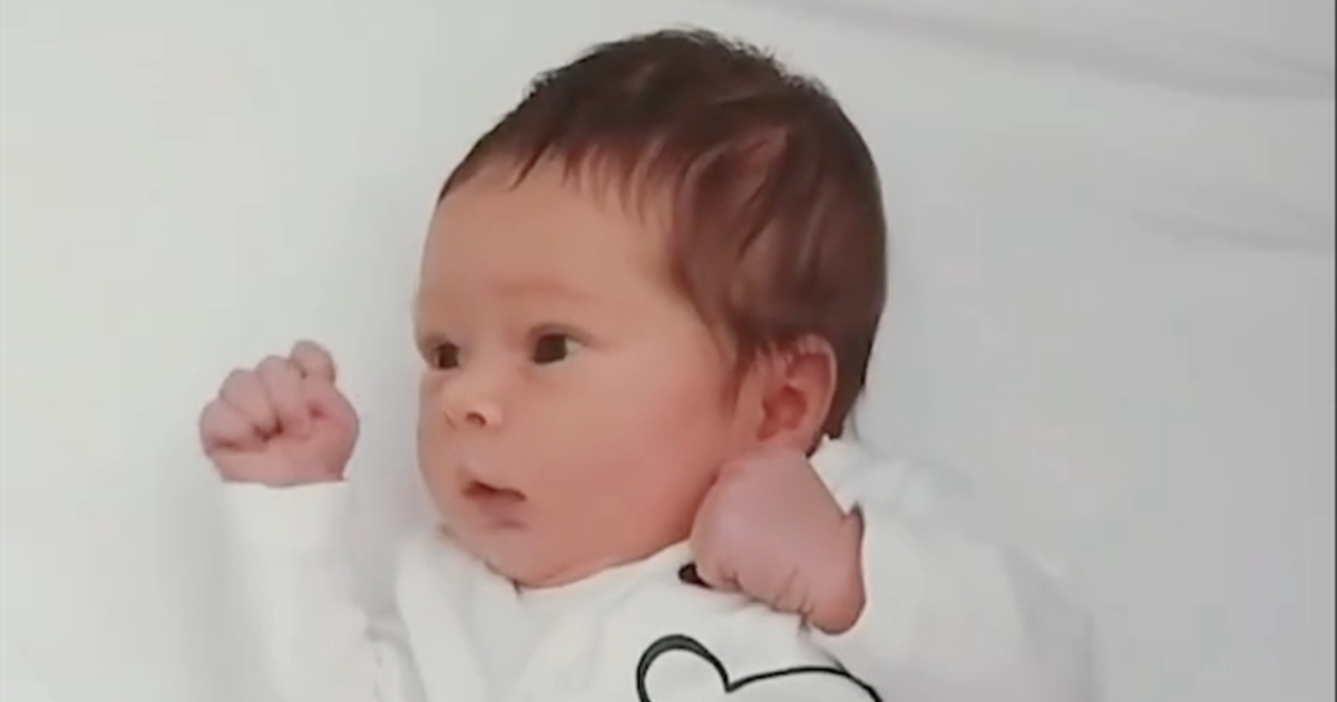 黒髪で黒い瞳の赤ちゃんが数年後……「わあ！」　ママびっくりのビフォーアフターに「魔法のよう」【海外】（1/3） | ライフスタイル ねとらぼ