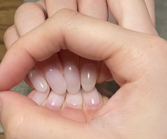 これは“歯”すぎる