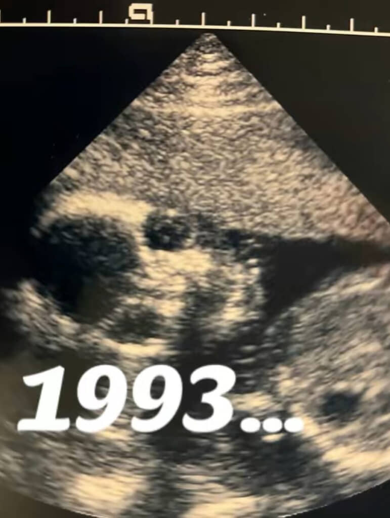 仲良し夫婦の34年後