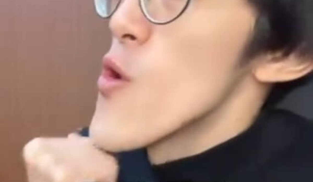 友達に「なんかアゴ長くない？」と言われた男性　レントゲンを撮ったら……衝撃の結果が458万再生「見れば見るほど凄い」（1/3） | ライフスタイル ねとらぼ