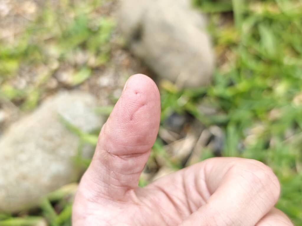 何度もかまれて指に穴が……