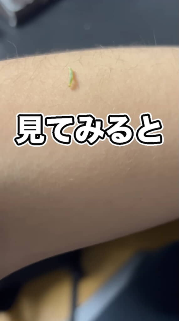 腕になんかいる！