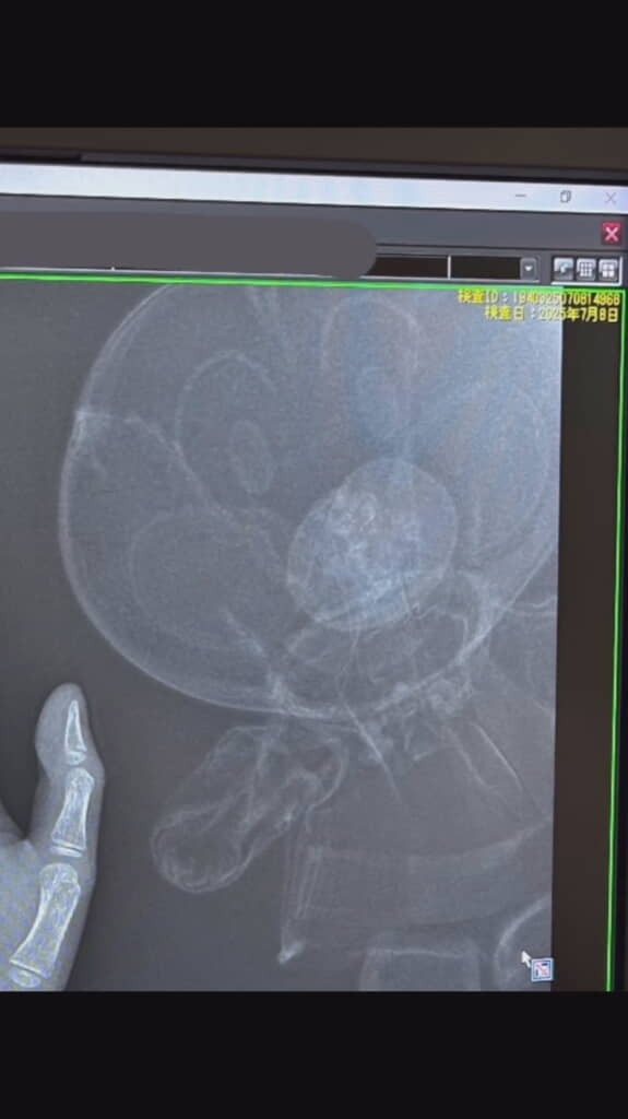 アンパンマンも異常なし