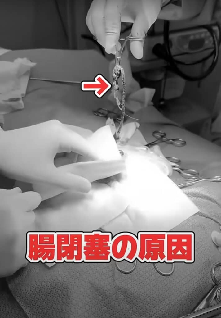 腸の中からひも状のおもちゃが出て来ました