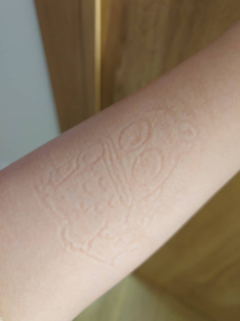 きれいな跡が……！（画像提供：おみドン／@omidon_donさん）