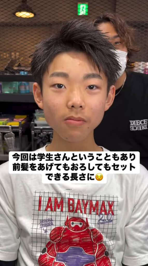 アフター（施術後）