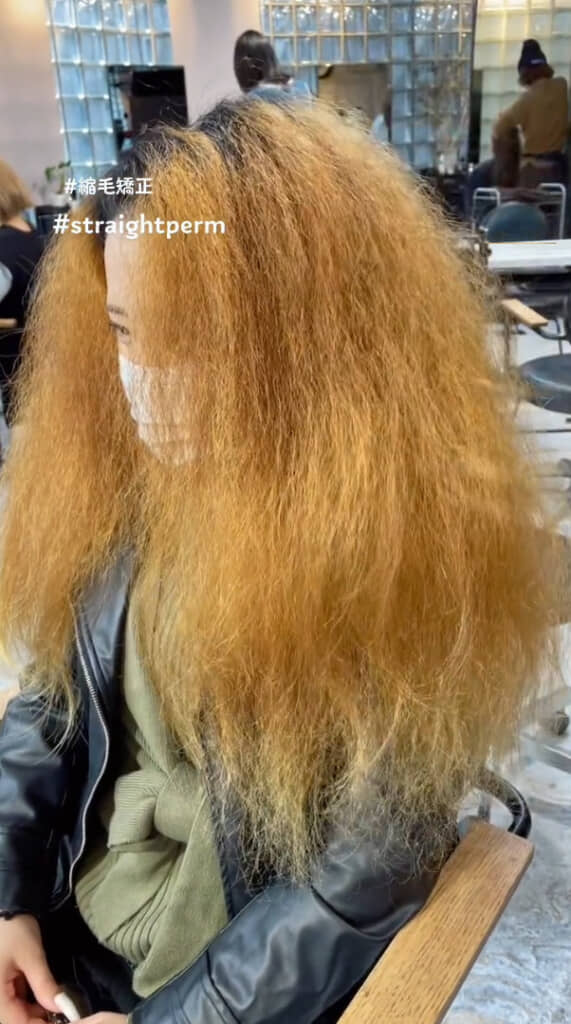 施術前（ビフォー）