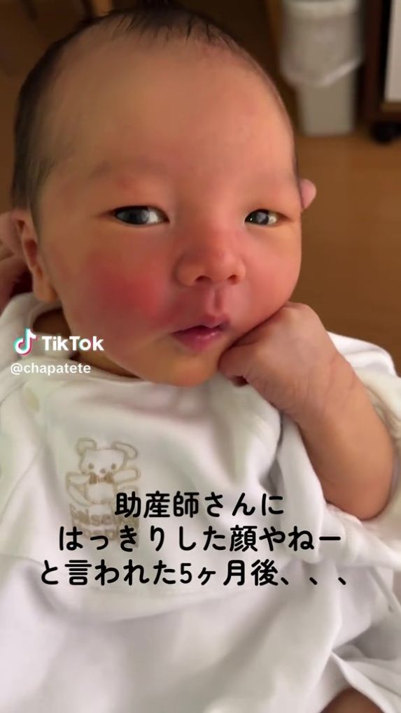 生まれたてのベビまるくん（ビフォー）