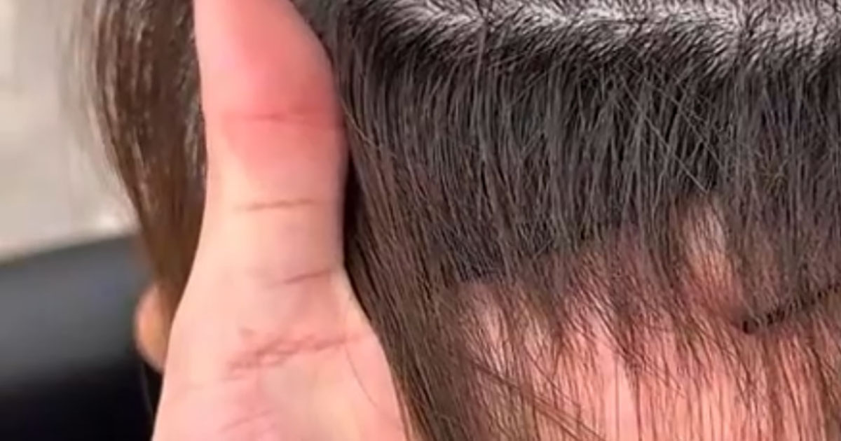 美容師「おい、やってくれたな！」　雑にカットされた多毛女性→プロが直すと……「素敵です」　“ビフォーアフター”に反響（1/3） | 美容 ねとらぼ