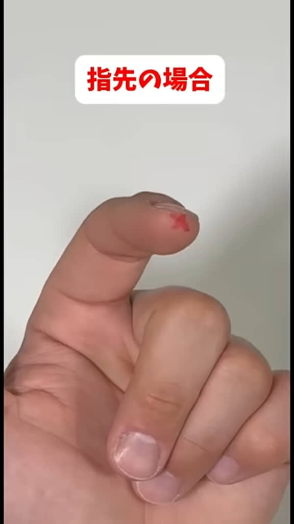 自衛隊が教える絆創膏の貼り方