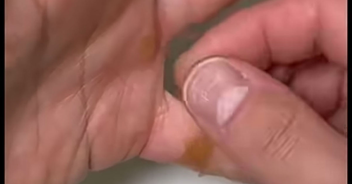 「知っていると、すごく便利！」　自衛隊員が教える“絆創膏がはがれないコツ”が目からウロコ　「こんど試してみます」（1/2） | ライフハック ねとらぼ