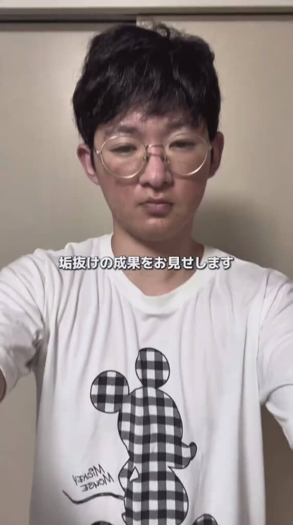 beforeはこんな感じ