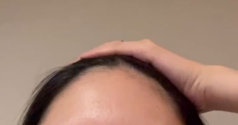 産後ママ、前髪を押さえてパッと離したら……　まさかの光景に「うわぁー」「今まさにこれで、どうしたらいいですか？」（1/3） | 教育・子育て ねとらぼ