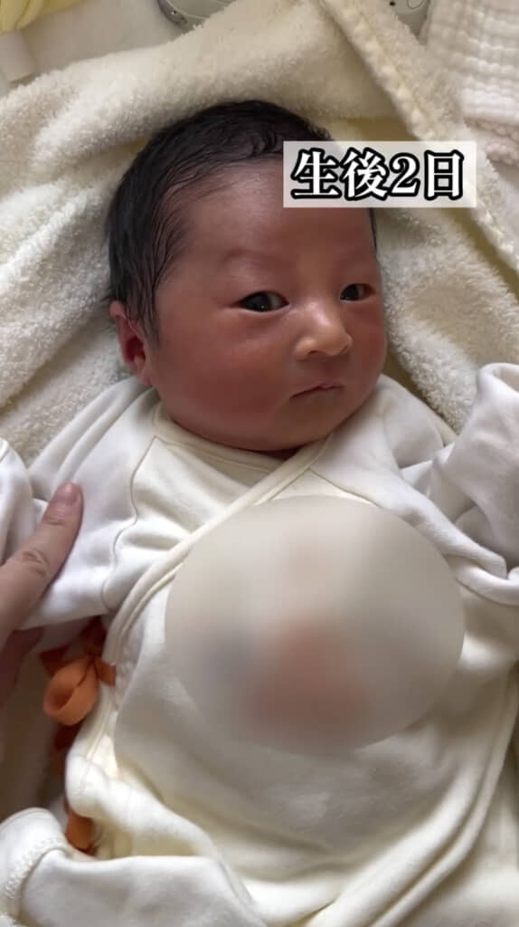 2日後にはぱっちりおめめに