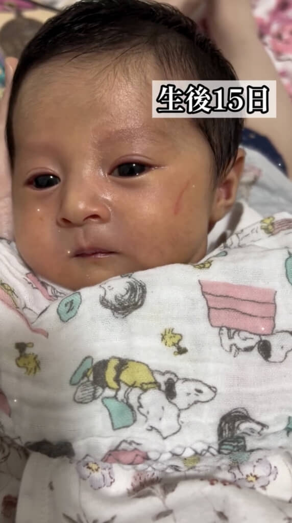 15日目にはすっかりふたえに！