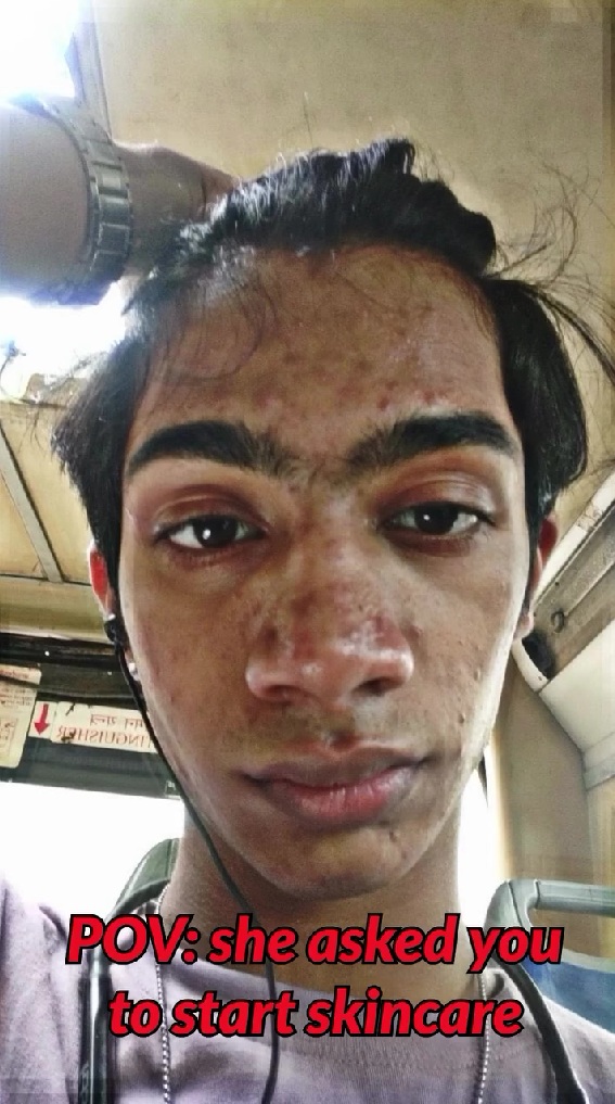 彼女に「スキンケアを始めてみたら？」と勧められ……男性の驚きのビフォーアフターに「めちゃくちゃかっこいい！」「ここまで変わるとは」【海外】