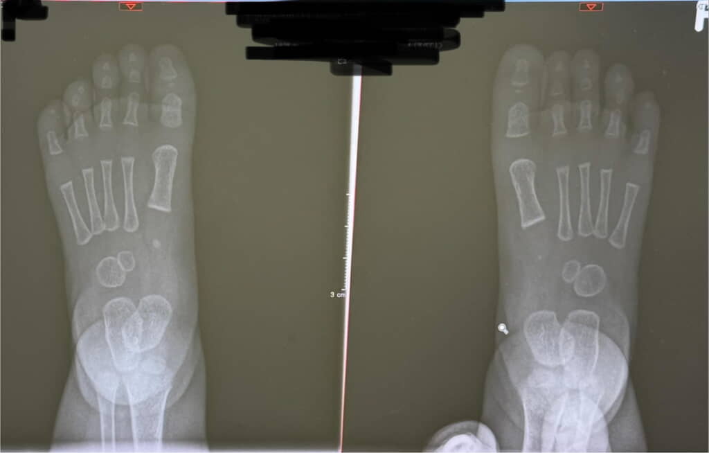 この発育途上な感じが愛おしい
