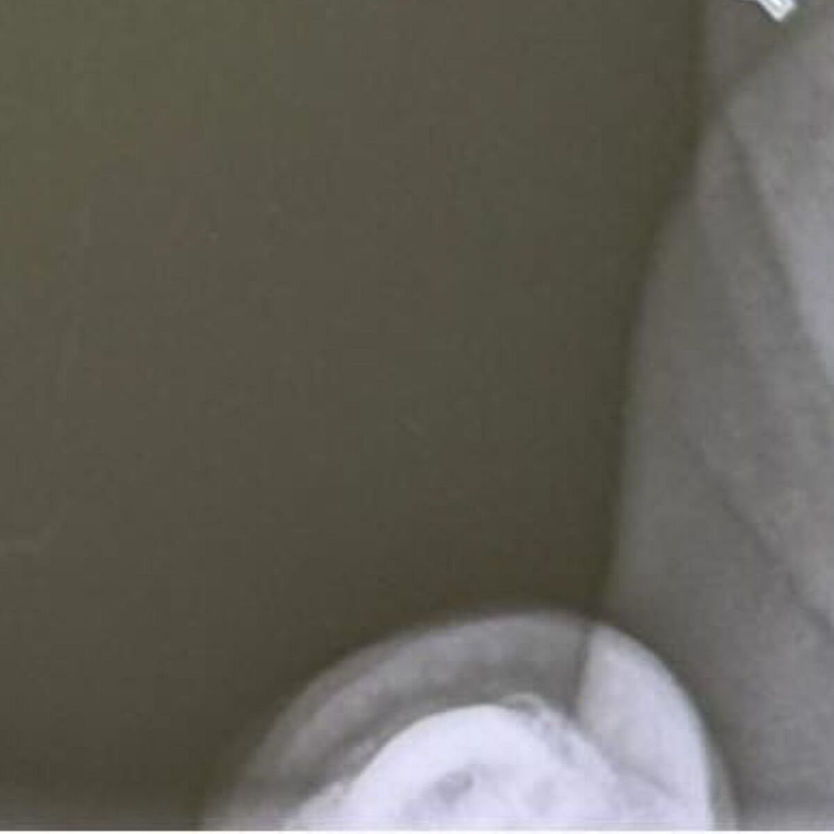 9カ月赤ちゃんと病院へ→レントゲンを撮ったら……　「えっすごい」予想外すぎる1枚にママ仰天「宇宙空間みたい」（1/3） | 育児 ねとらぼ