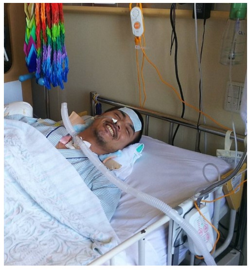 自転車転倒事故で脊髄損傷の大けがを負った滝川英治