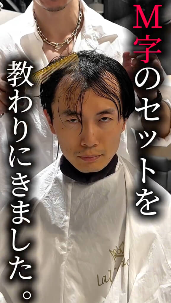 薄毛をどうにかしたい