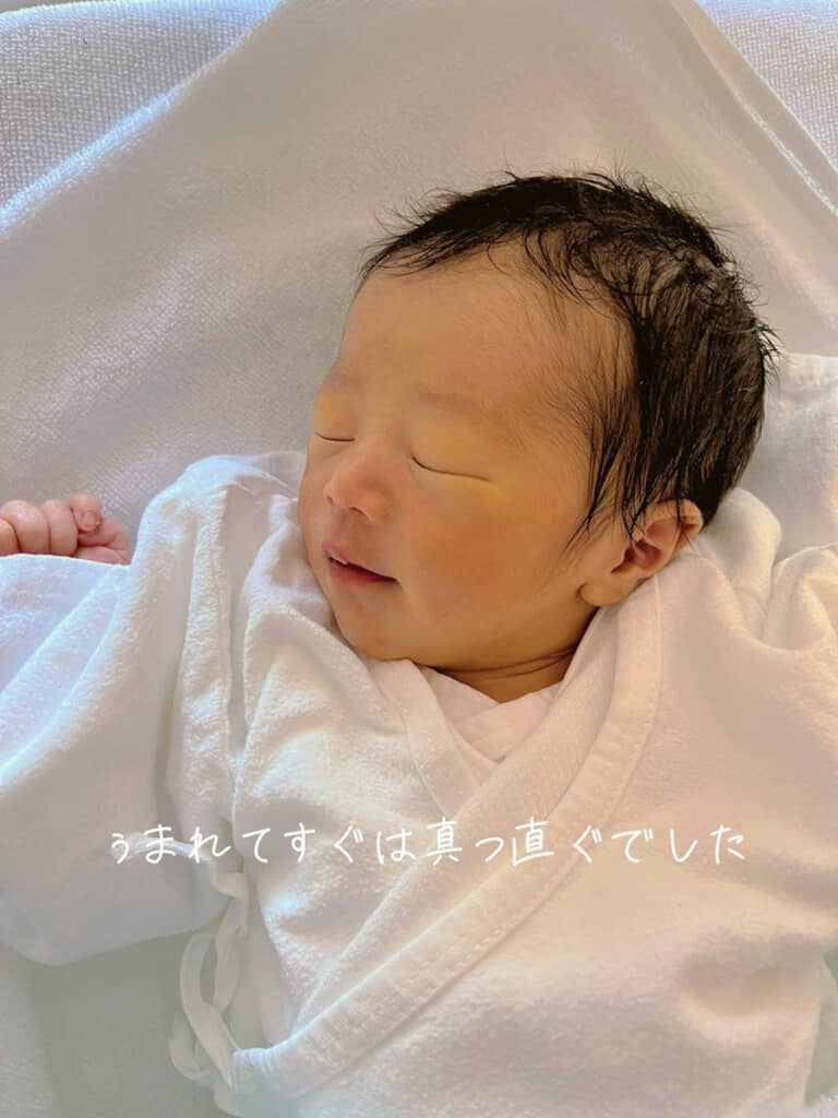 生後まもない赤ちゃんの様子