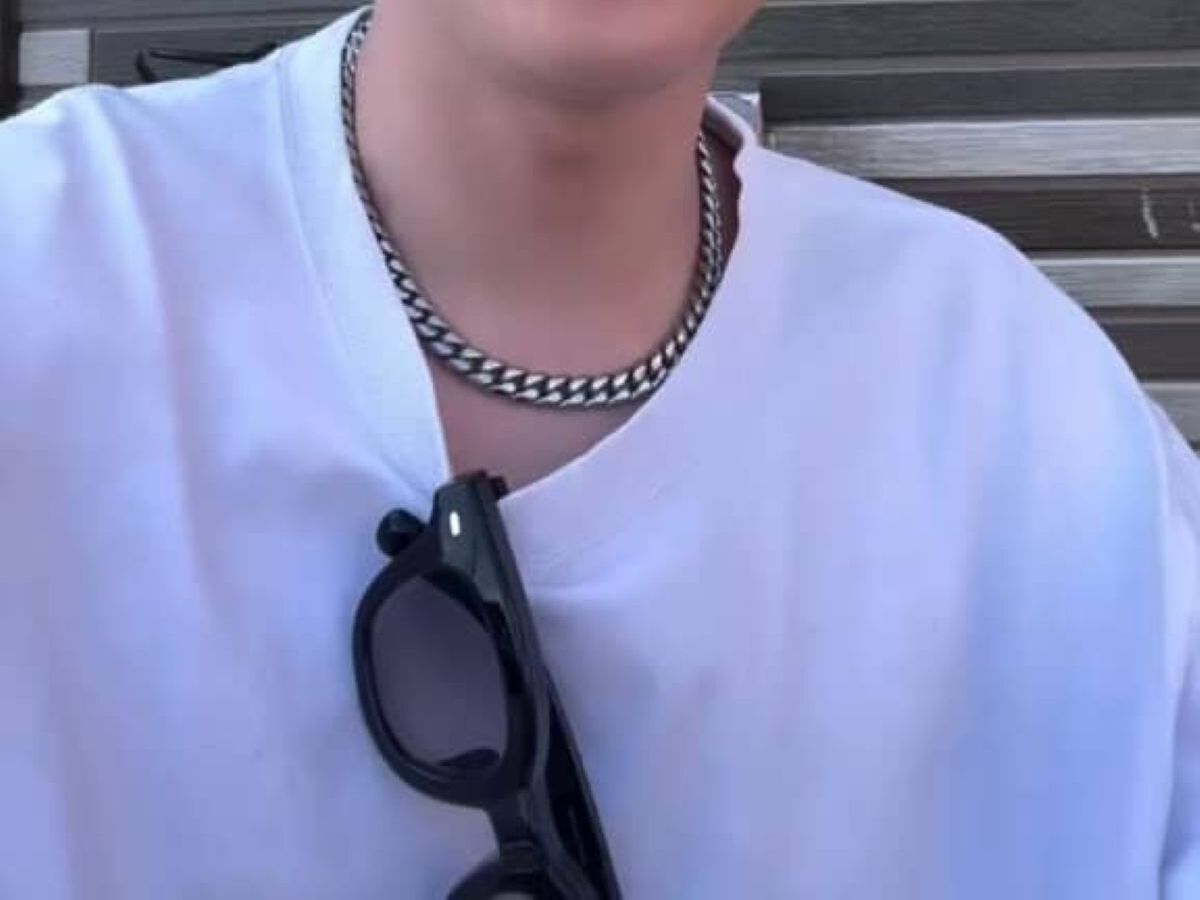 外出中、顔に“何か”止まり→目を開けると……　「気まずいて」思わぬ光景に「笑い止まらん」「奇跡」と318万再生 | その他生き物 ねとらぼ