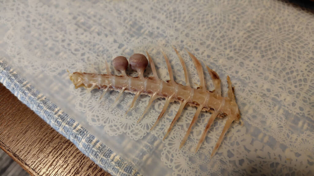 この背骨、なんか変……？