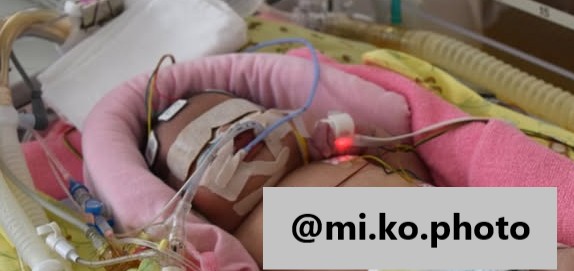 生後1日目「低体温療法」中の娘さん（投稿者提供画像）