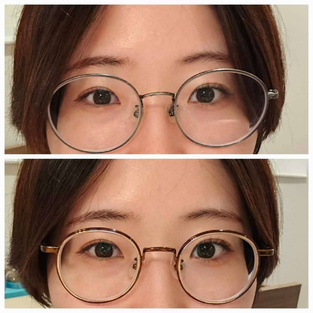 普通の眼鏡と目が小さくならない眼鏡をそれぞれ着用して目元を比較