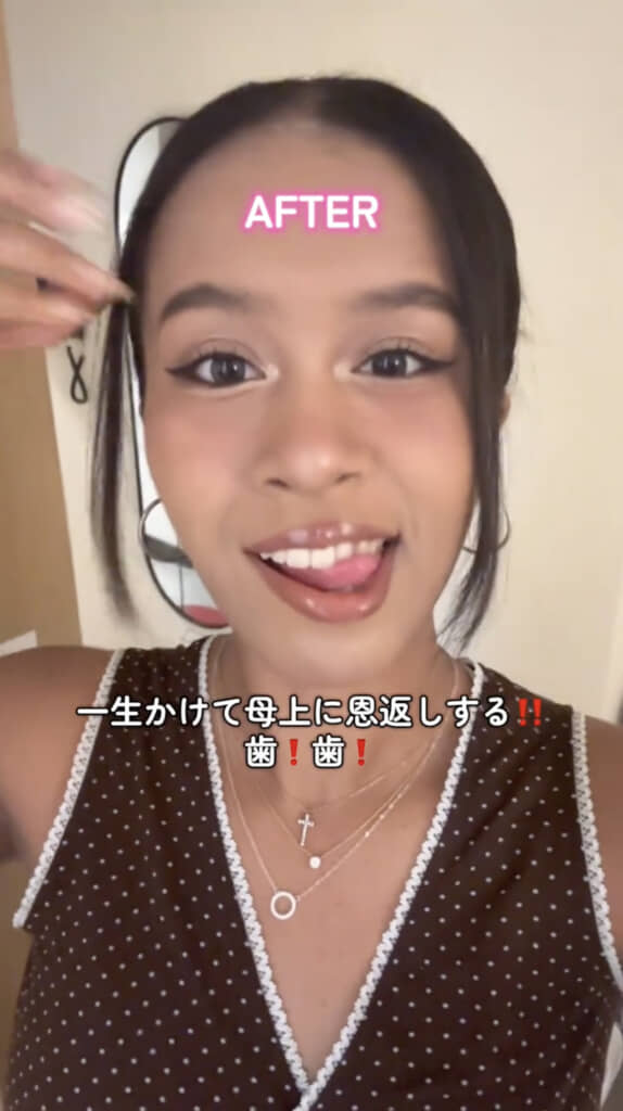 口を開けて笑えるようになりました