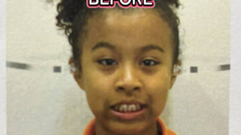 出っ歯すぎて口が開いていた子ども時代→母が100万かけて矯正してくれて……「変わりましたね」　“現在の姿”に感動「青春楽しんで」（1/2） | ライフスタイル ねとらぼ