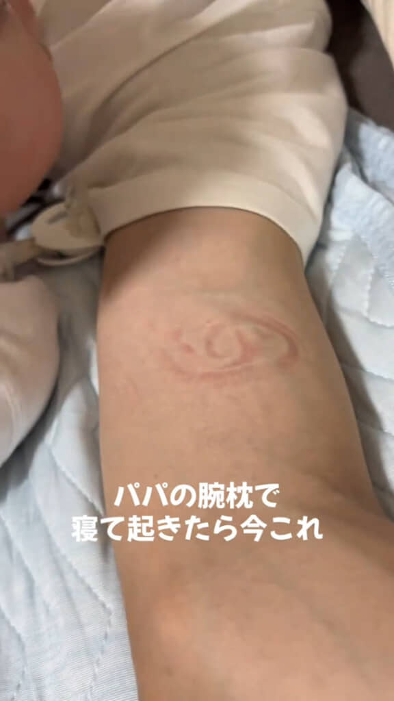 きれいに耳の跡が残っていました（！）