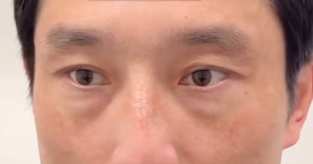 婚活中の37歳男性、初めて眉毛サロンに行ってみたら……「まるで違う」　驚きのビフォーアフターが440万再生「素敵！」（1/2） | 美容 ねとらぼ