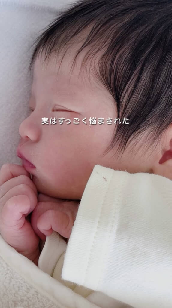 生まれつきフサフサだった娘