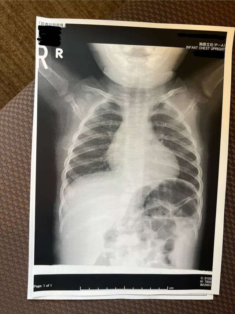 顔にある白いものは……