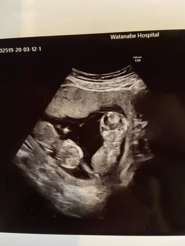 ママのお腹の中で過ごしている双子ちゃん