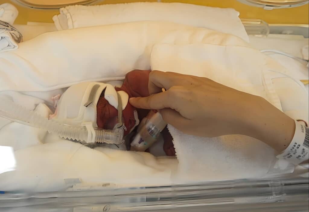 1070グラムで生まれた赤ちゃん