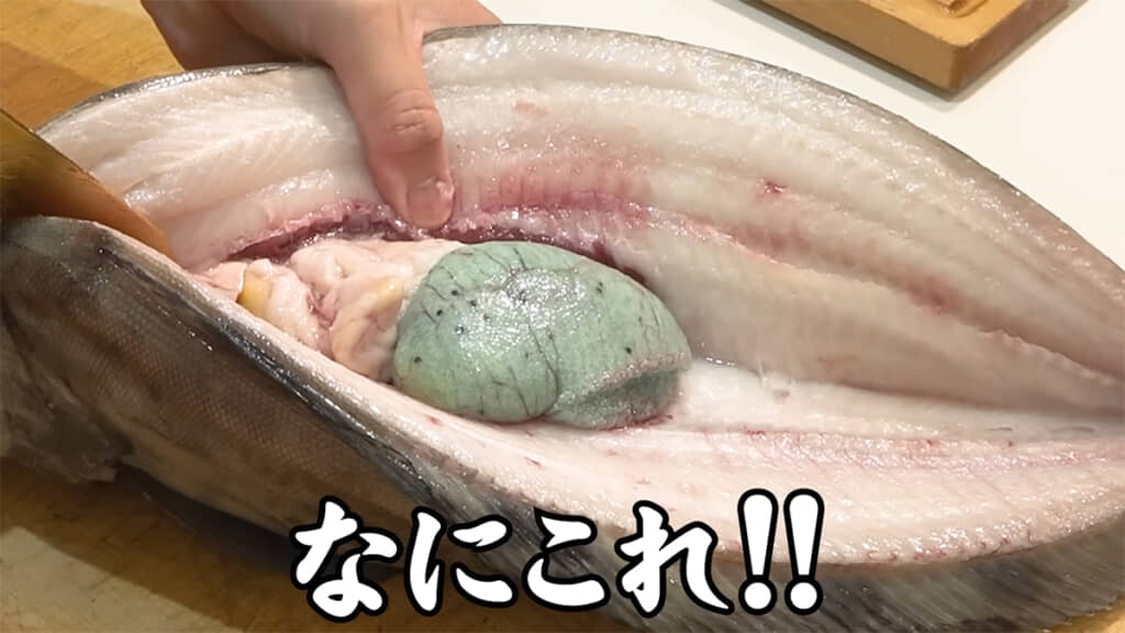 おなかの中からとんでもないものが出てきました