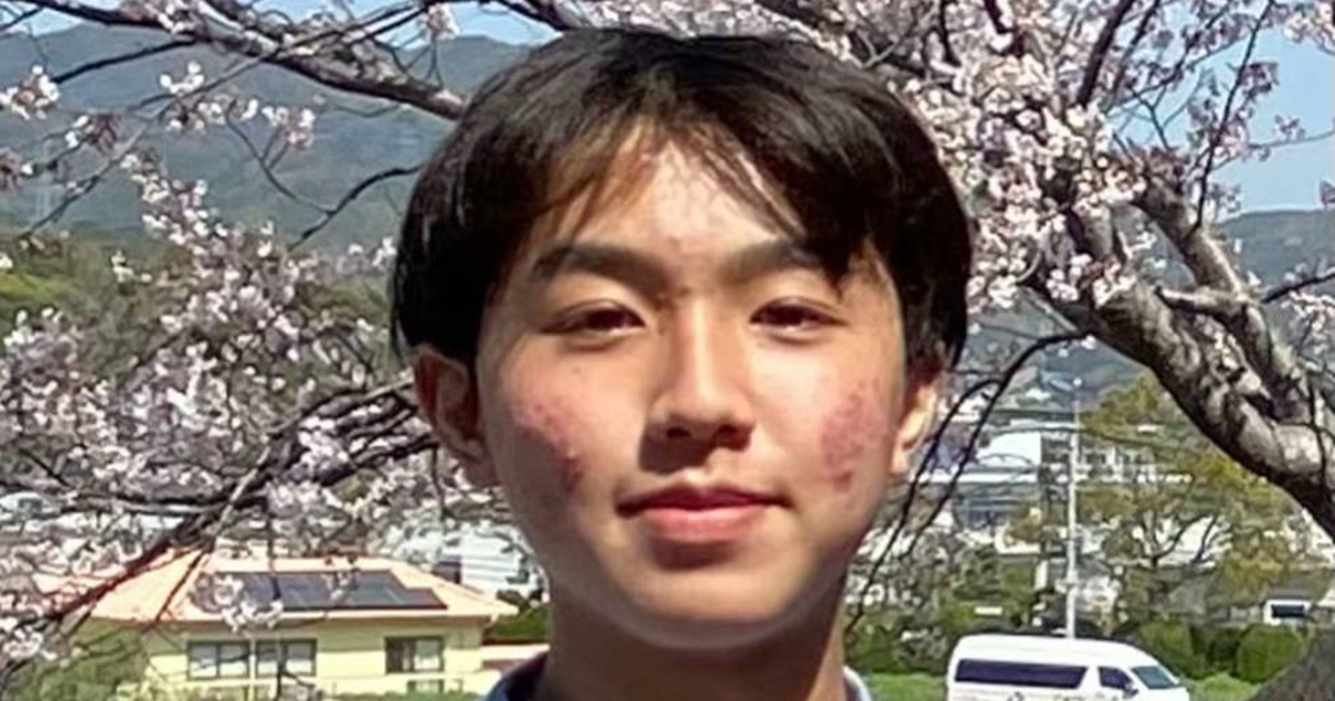 「ニキビ爆発」してた中2男子→6年後……「えっぐ」　青学生になった“現在の姿”に衝撃「そりゃ誰も勝てんわ」「かっけぇぇぇ!!!」（1/2） | 美容 ねとらぼ