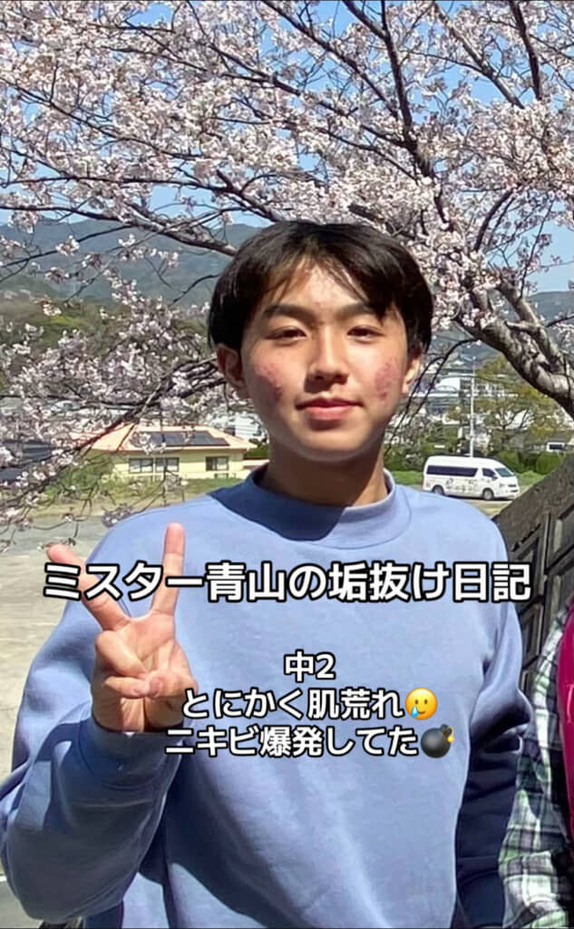 中学2年生ごろの隈部さん