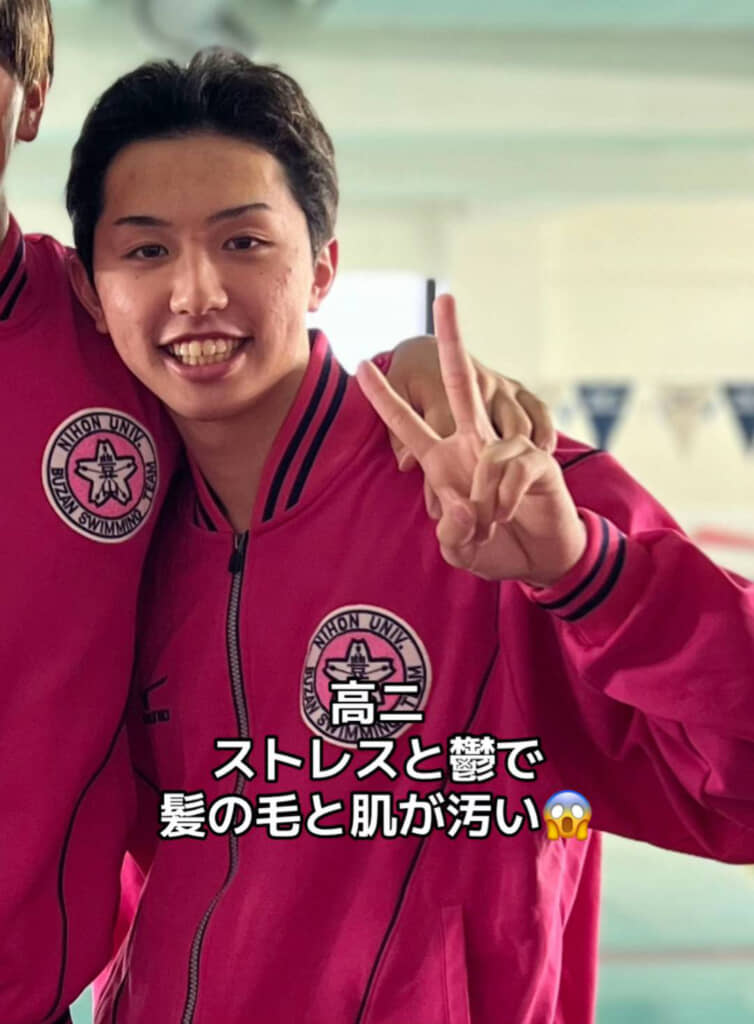 肌荒れに悩んでいた時期