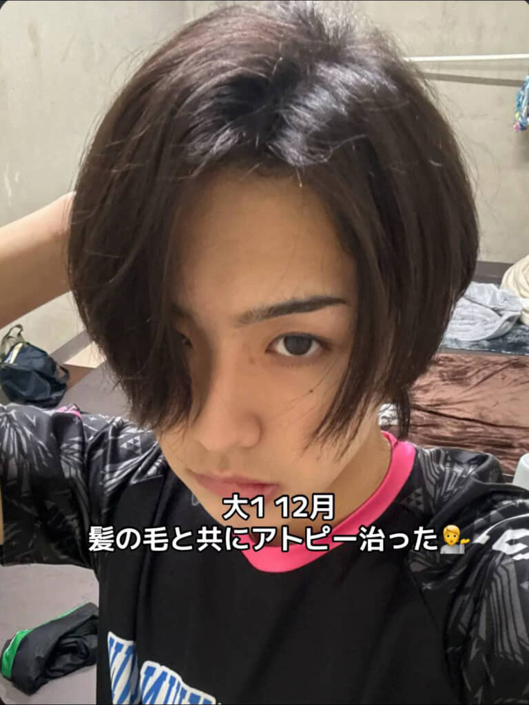 アトピーはすっかり良くなりました