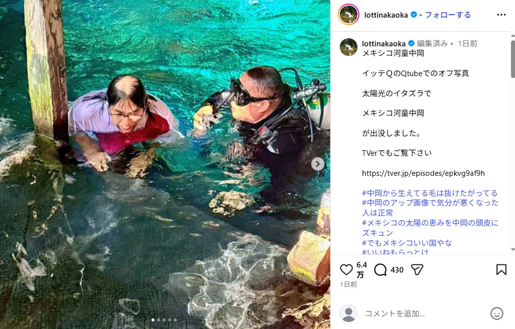 ロッチ中岡創一の頭皮