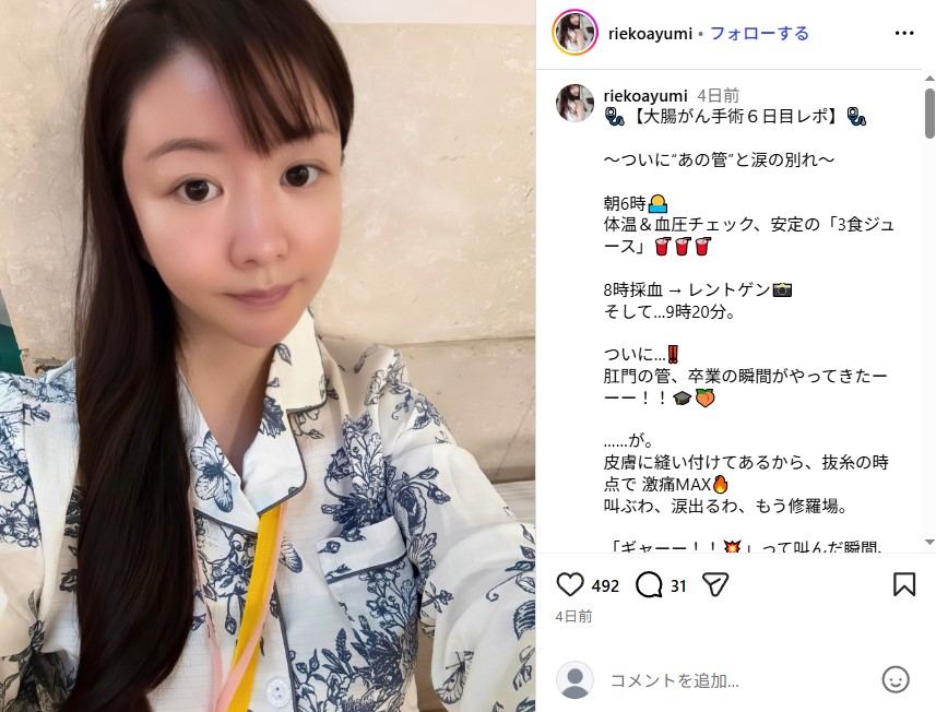 大腸がんの手術を受けたタレント・歩りえこ